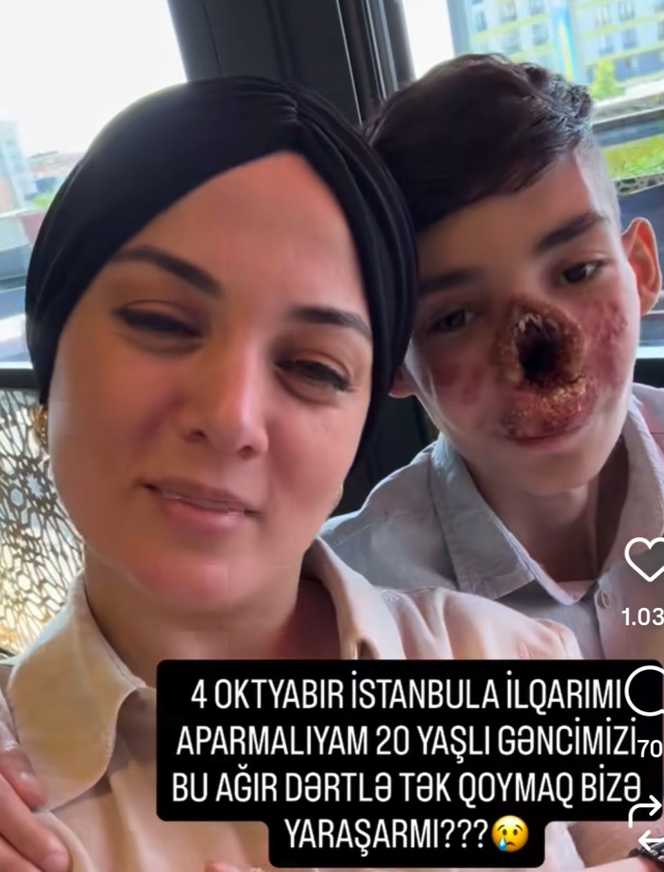 20 yaşlı İlqarın mübarizəsi yüzlərlə xəstənin ümidinə çevrildi