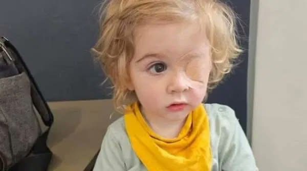 2 yaşındakı Juvan qohumu tərəfindən öpüldükdən sonra gözünü itirib.